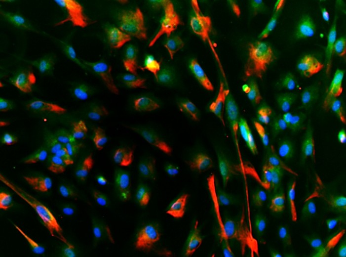 Axol-Bioscience-human-iPSC-image-human-ipsc-derived-astrocytes.jpg