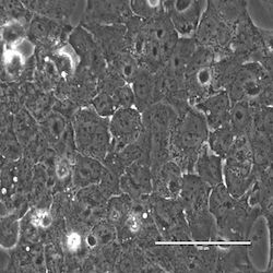 Axol-Bioscience-human-iPSC-image-Assay-Ready.jpeg