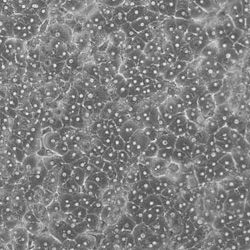 Axol-Bioscience-human-iPSC-image-Primary.jpeg