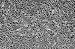 Axol-Bioscience-human-iPSC-image-ir_attachment_22741.jpg