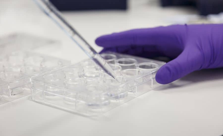 Axol-Bioscience-human-iPSC-image-ir_attachment_78527.jpeg