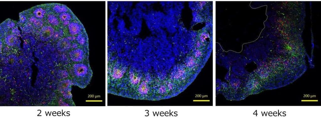 iPSC derived organoids in a cell culture dish