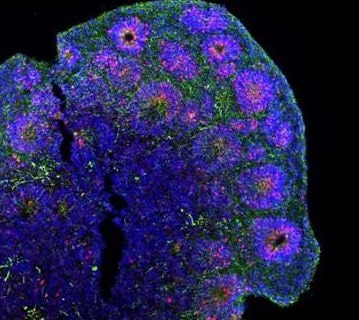 organoid