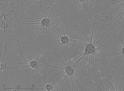 axoCells motor neurons demonstrate expected physiological morphology with uniform cell clusters and large cabling neuronal networks.