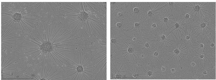 ALS-derived motor neurons form smaller, less uniform bodies with thinner neurite extensions compared to healthy axoCells motor neurons.